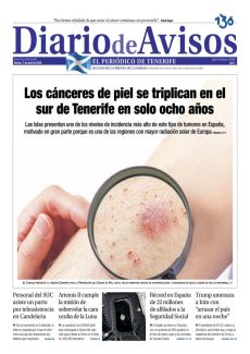 LOS CÁNCERES DE PIEL SE TRIPLICAN EN EL SUR DE TENERIFE EN SOLO OCHO AÑOS